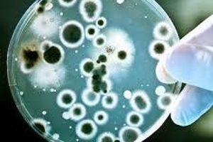 Бактеріологічні дослідження
